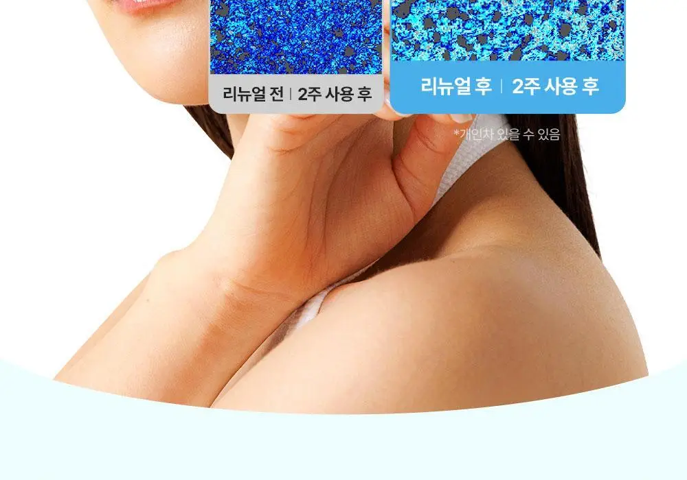 [리뉴얼/속수분쏙] 리얼베리어 워터리 히알 세럼 50ml 기획 (+20ml) 상세페이지 17